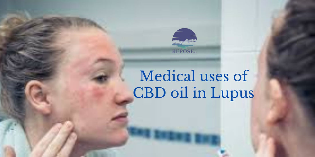 Medical uses of CBD oil in Lupus